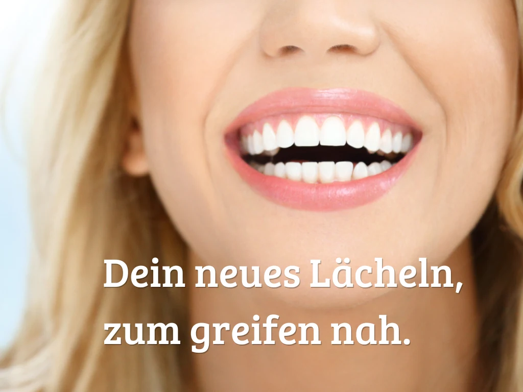 Oberkiefer mit neuen Kronen nach einer Behandlung in einer Partnerklinik
