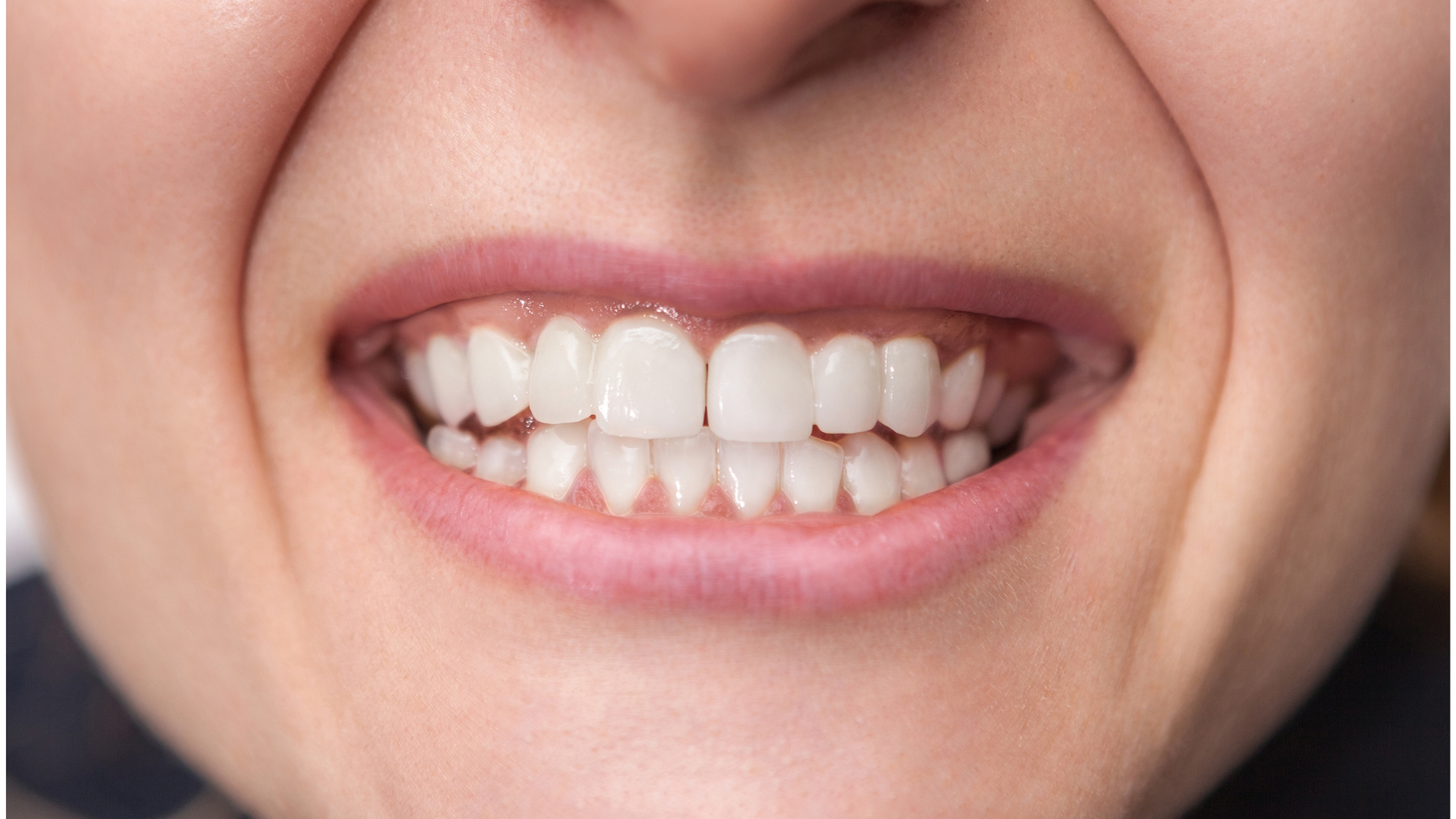 Nachher-Bild Zahnbehandlung